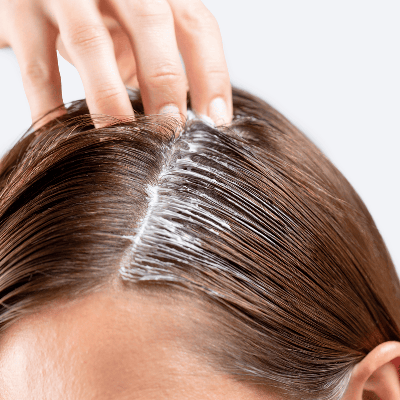 Person applying a white cream or gel to their hairline on a plain background