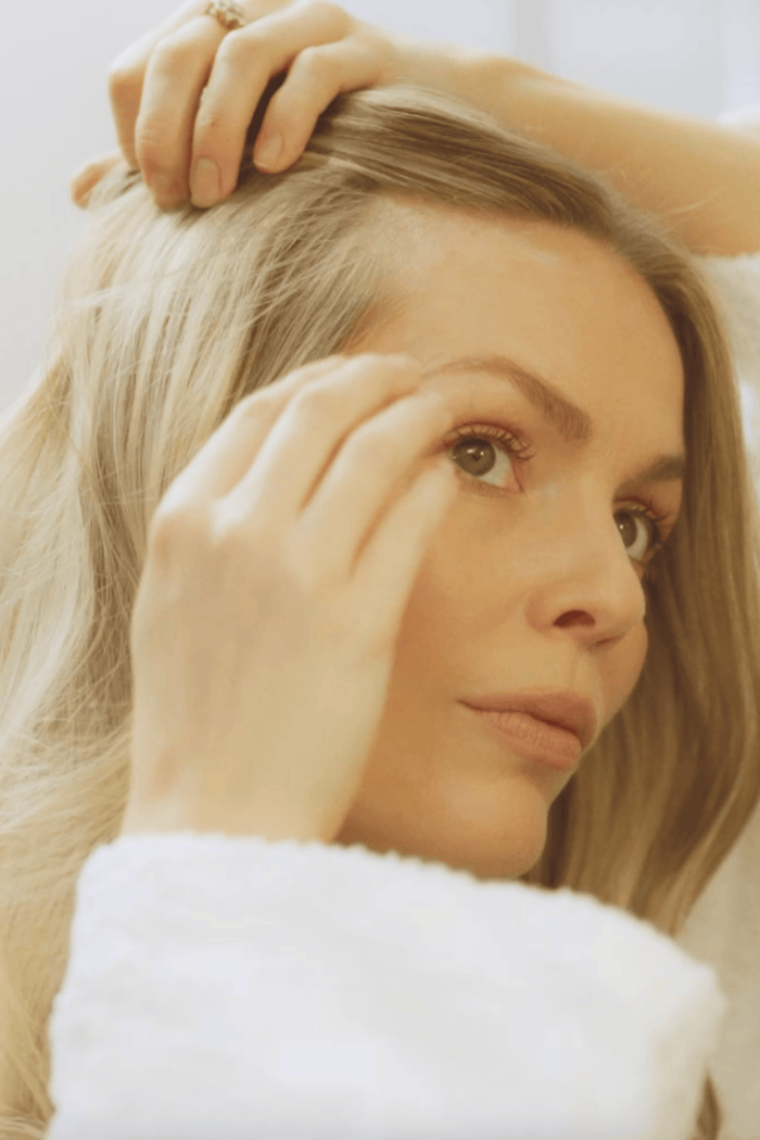 woman showing hair line and scalp