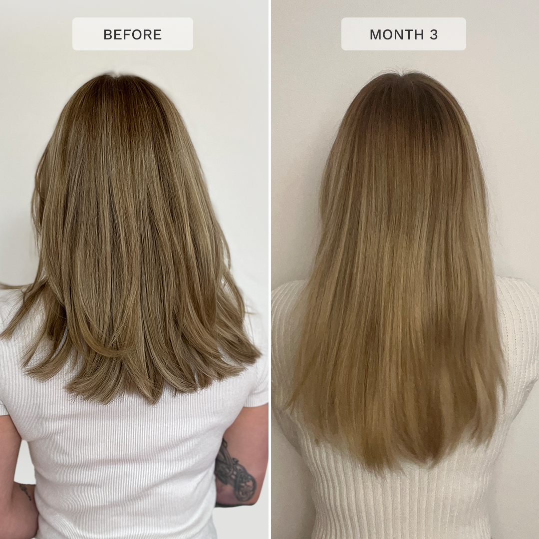 Advanced+ Hair Supplement - Powerful Hair Growth Vitamin – Hairburst