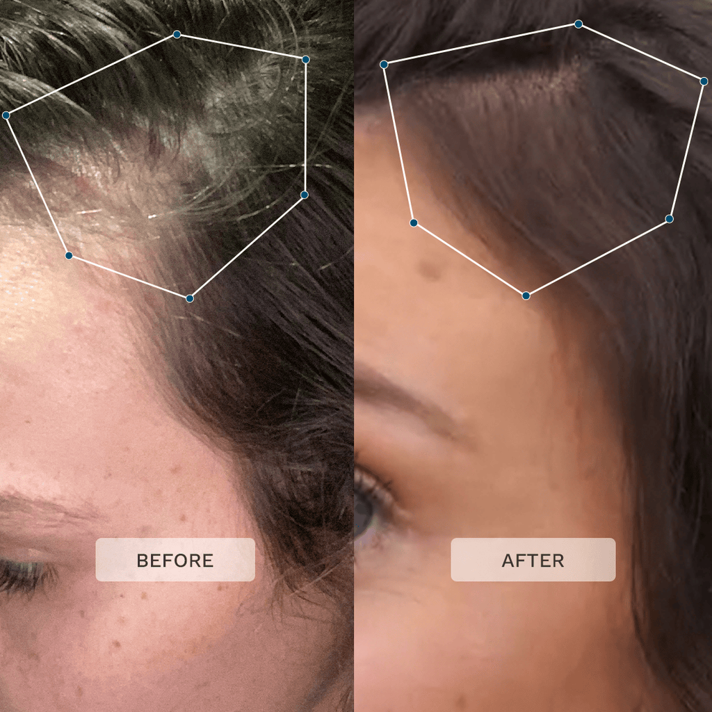 Hairburst Multi-Active Hair Growth Serum