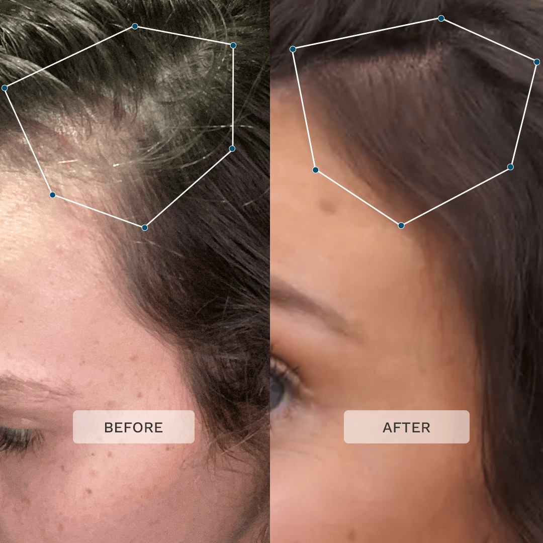 Hairburst Multi-Active Hair Growth Serum